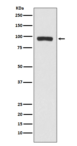 Butyrylcholinesterase Antibody in Western Blot (WB)