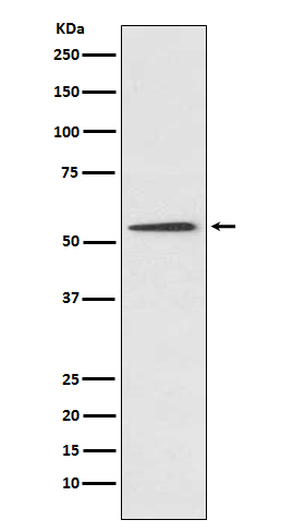 Protein C Antibody in Western Blot (WB)