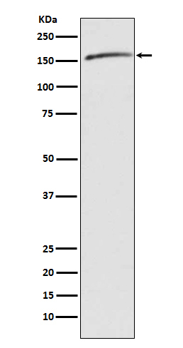Drosha Antibody in Western Blot (WB)