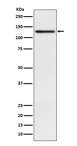 Involucrin Antibody in Western Blot (WB)