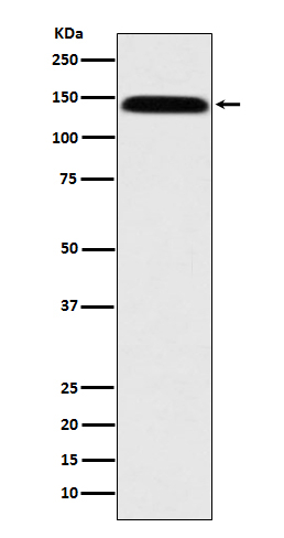 Leptin Receptor Antibody in Western Blot (WB)