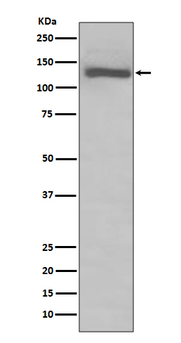 TLR7 Antibody in Western Blot (WB)