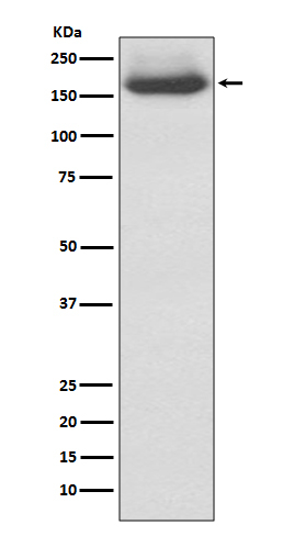NF-M Antibody in Western Blot (WB)