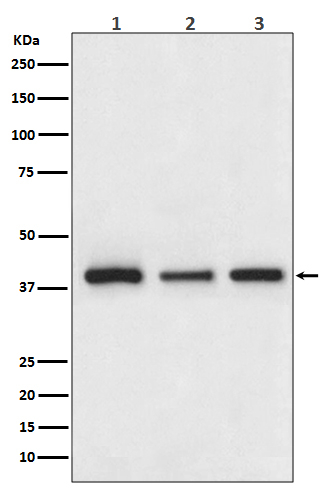 Cathepsin H/K/L/V Antibody in Western Blot (WB)