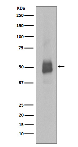 Phospho-Lyn (Tyr397) Antibody in Western Blot (WB)