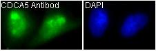 CDCA5 Antibody in Immunocytochemistry (ICC/IF)