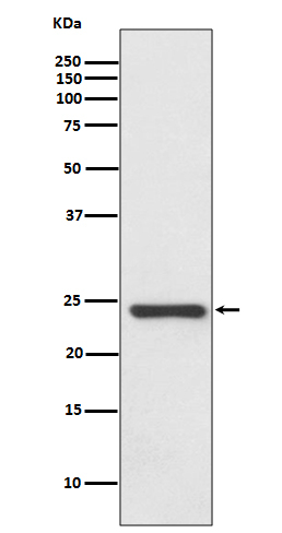 HSPB8 Antibody in Western Blot (WB)