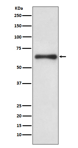 Cdc6 Antibody in Western Blot (WB)