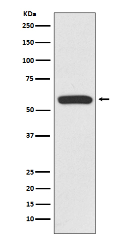 IRF6 Antibody in Western Blot (WB)