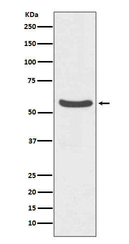 GLUT2 Antibody in Western Blot (WB)