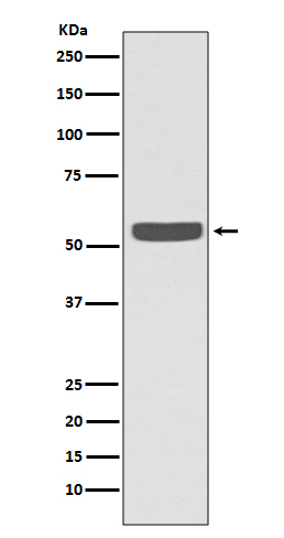 Cytokeratin 2e Antibody in Western Blot (WB)