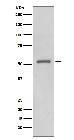 MMP11 Antibody in Western Blot (WB)