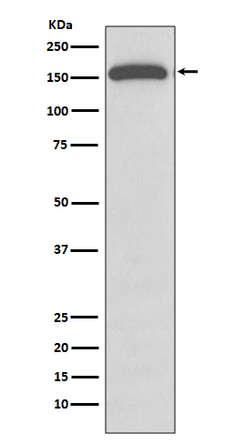 GLI1 Antibody in Western Blot (WB)