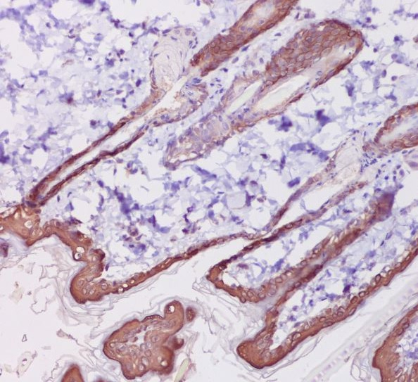 Cytokeratin 1 Antibody in Immunohistochemistry (Paraffin) (IHC (P))