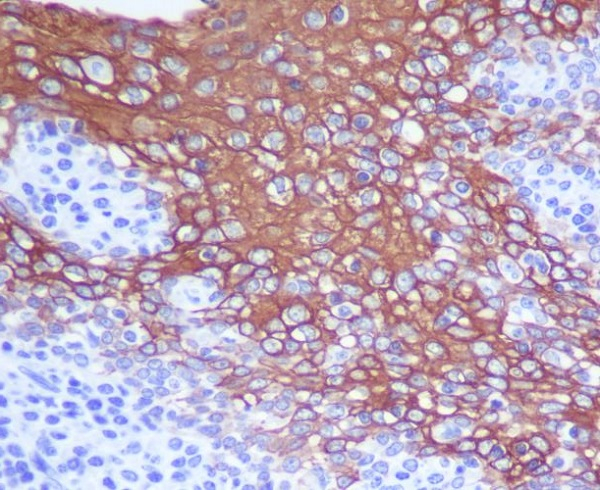 Cytokeratin 13 Antibody in Immunohistochemistry (Paraffin) (IHC (P))