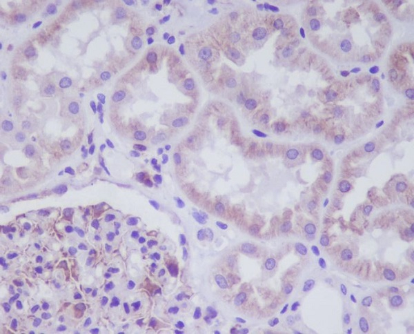 Adiponectin Receptor 1 Antibody in Immunohistochemistry (Paraffin) (IHC (P))