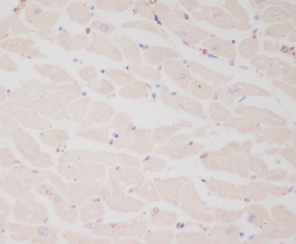 MYL2 Antibody in Immunohistochemistry (Paraffin) (IHC (P))