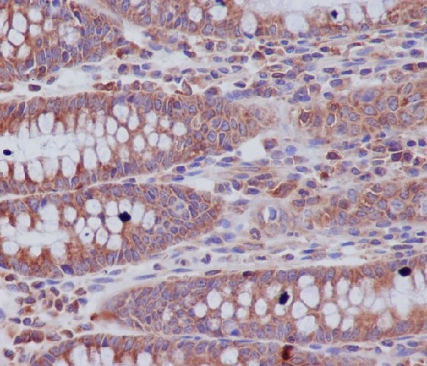 ABCF1 Antibody in Immunohistochemistry (Paraffin) (IHC (P))