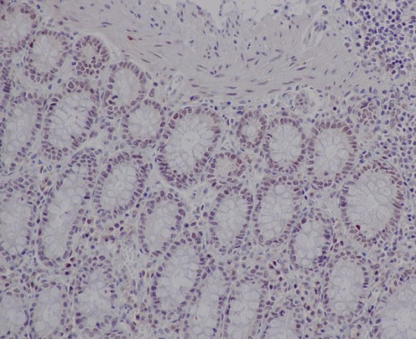 Ku80 Antibody in Immunohistochemistry (Paraffin) (IHC (P))