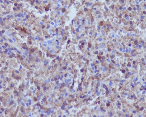 Hemoglobin alpha Antibody in Immunohistochemistry (Paraffin) (IHC (P))