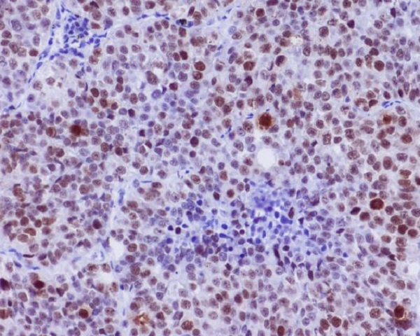 Phospho-c-Myc (Ser62) Antibody in Immunohistochemistry (Paraffin) (IHC (P))