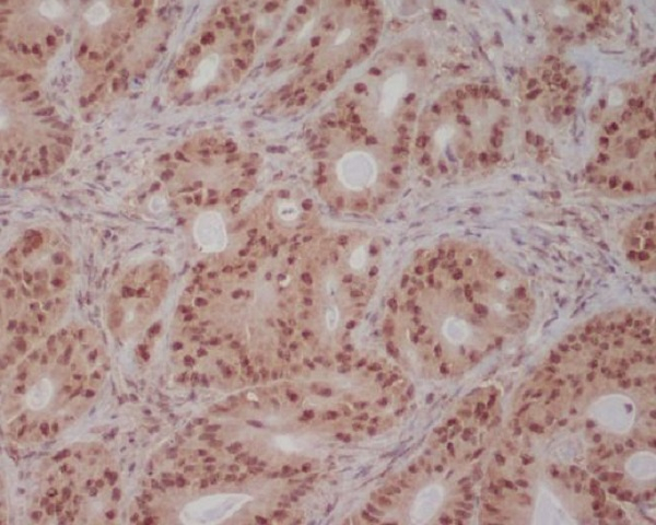 PI3K p85 Antibody in Immunohistochemistry (Paraffin) (IHC (P))