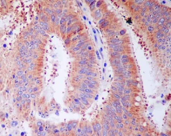 RPS3 Antibody in Immunohistochemistry (Paraffin) (IHC (P))