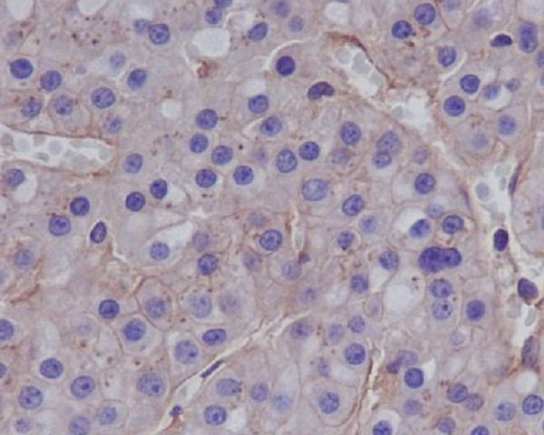 MMP1 Antibody in Immunohistochemistry (Paraffin) (IHC (P))