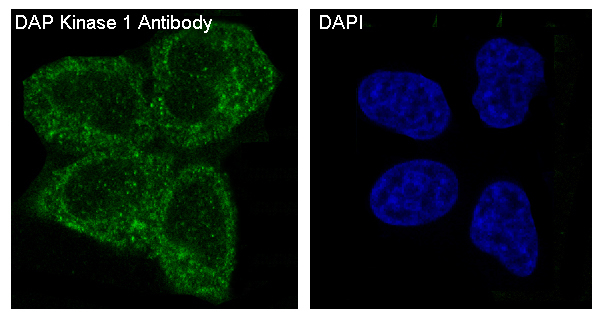 DAPK1 Antibody in Immunocytochemistry (ICC/IF)