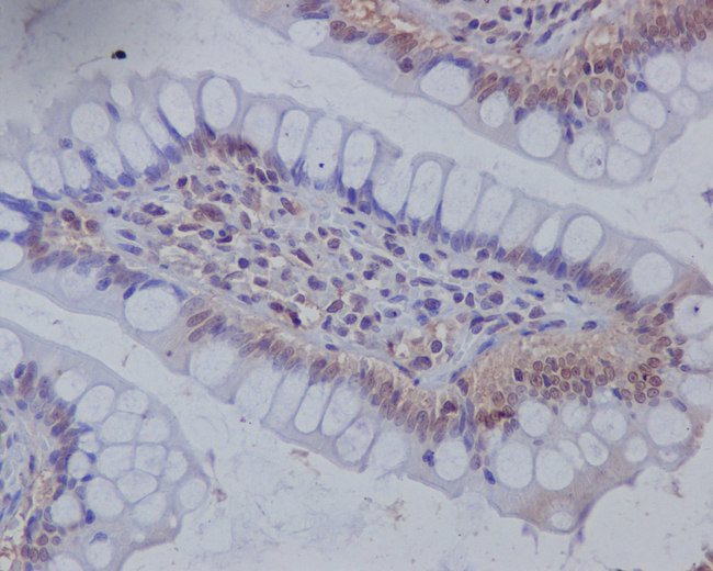 MSI1 Antibody in Immunohistochemistry (Paraffin) (IHC (P))