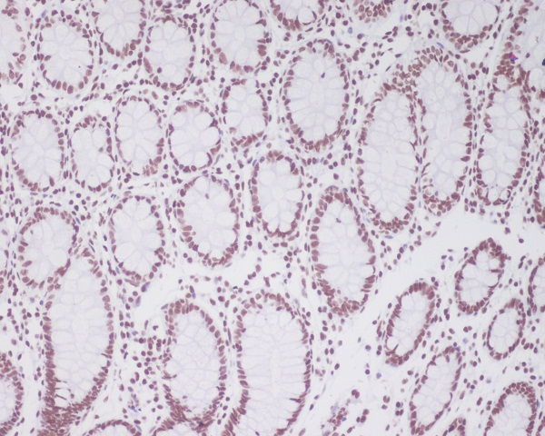 PAX2 Antibody in Immunohistochemistry (Paraffin) (IHC (P))