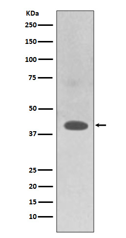 TRAM2 Antibody in Western Blot (WB)