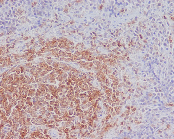 SHIP1 Antibody in Immunohistochemistry (Paraffin) (IHC (P))