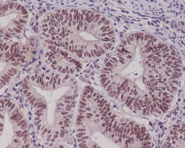 PYGO2 Antibody in Immunohistochemistry (Paraffin) (IHC (P))