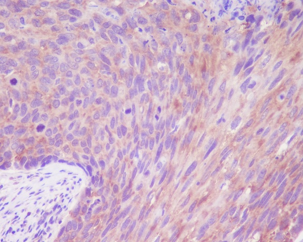 Desmoglein 1 Antibody in Immunohistochemistry (Paraffin) (IHC (P))
