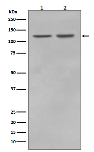 RNF20 Antibody in Western Blot (WB)