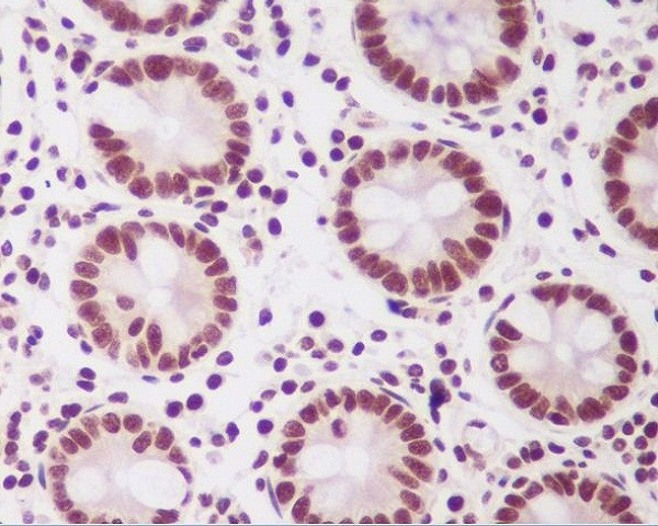 PTBP2 Antibody in Immunohistochemistry (Paraffin) (IHC (P))