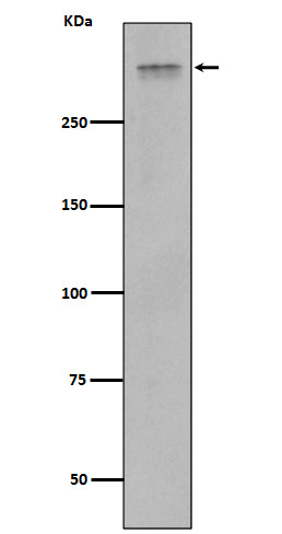 Plectin Antibody in Western Blot (WB)