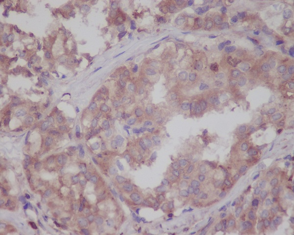 LRRK2 Antibody in Immunohistochemistry (Paraffin) (IHC (P))