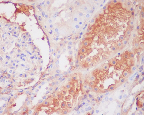 Complement C9 Antibody in Immunohistochemistry (Paraffin) (IHC (P))