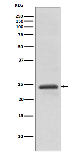 RAB11A Antibody in Western Blot (WB)