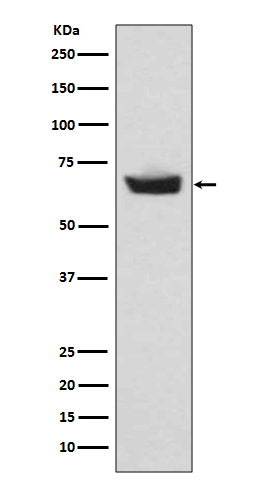 CETP Antibody in Western Blot (WB)