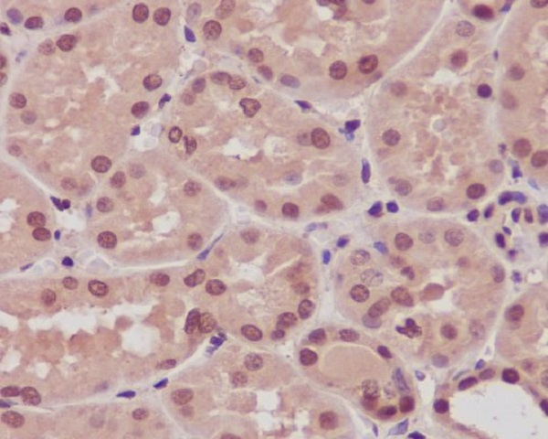 beta Arrestin 1 Antibody in Immunohistochemistry (Paraffin) (IHC (P))