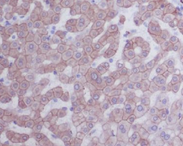 Cytokeratin 8 Antibody in Immunohistochemistry (Paraffin) (IHC (P))