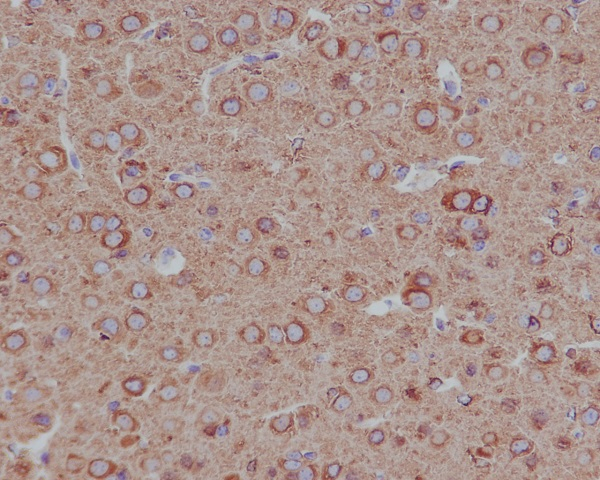 beta Tubulin 2 Antibody in Immunohistochemistry (Paraffin) (IHC (P))