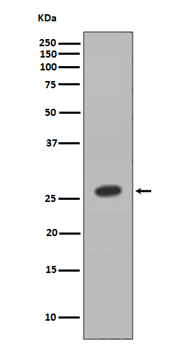 HOXB9 Antibody in Western Blot (WB)