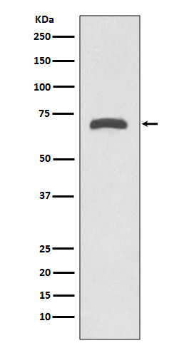 MMP8 Antibody in Western Blot (WB)