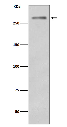 Dysferlin Antibody in Western Blot (WB)