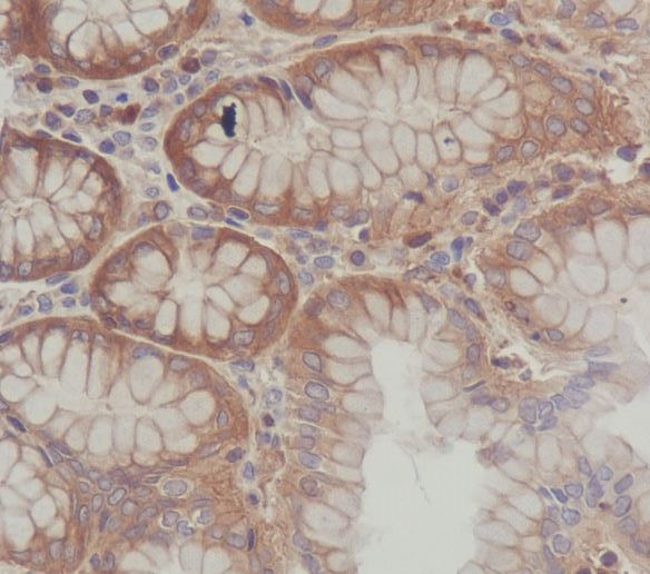 SCF Antibody in Immunohistochemistry (Paraffin) (IHC (P))