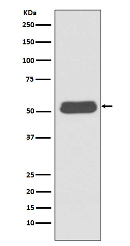 LSP1 Antibody in Western Blot (WB)